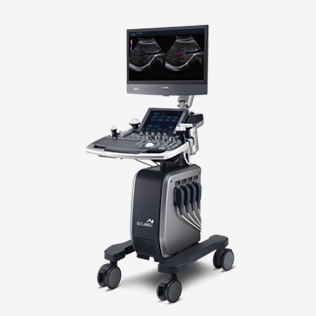초음파 진단기